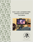 Day Case Laparoscopic Cholecystectomy 3rd  Edition