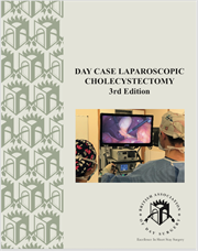 Day Case Laparoscopic Cholecystectomy 3rd  Edition