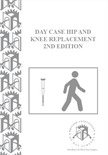 Day Case Hip & Knee Replacement 2nd Edition